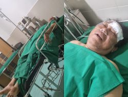 Kekerasan Terhadap Wartawan. Ketua DPW IWO-I Aceh Akan Ambil Jalur Hukum Terhadap Pelaku